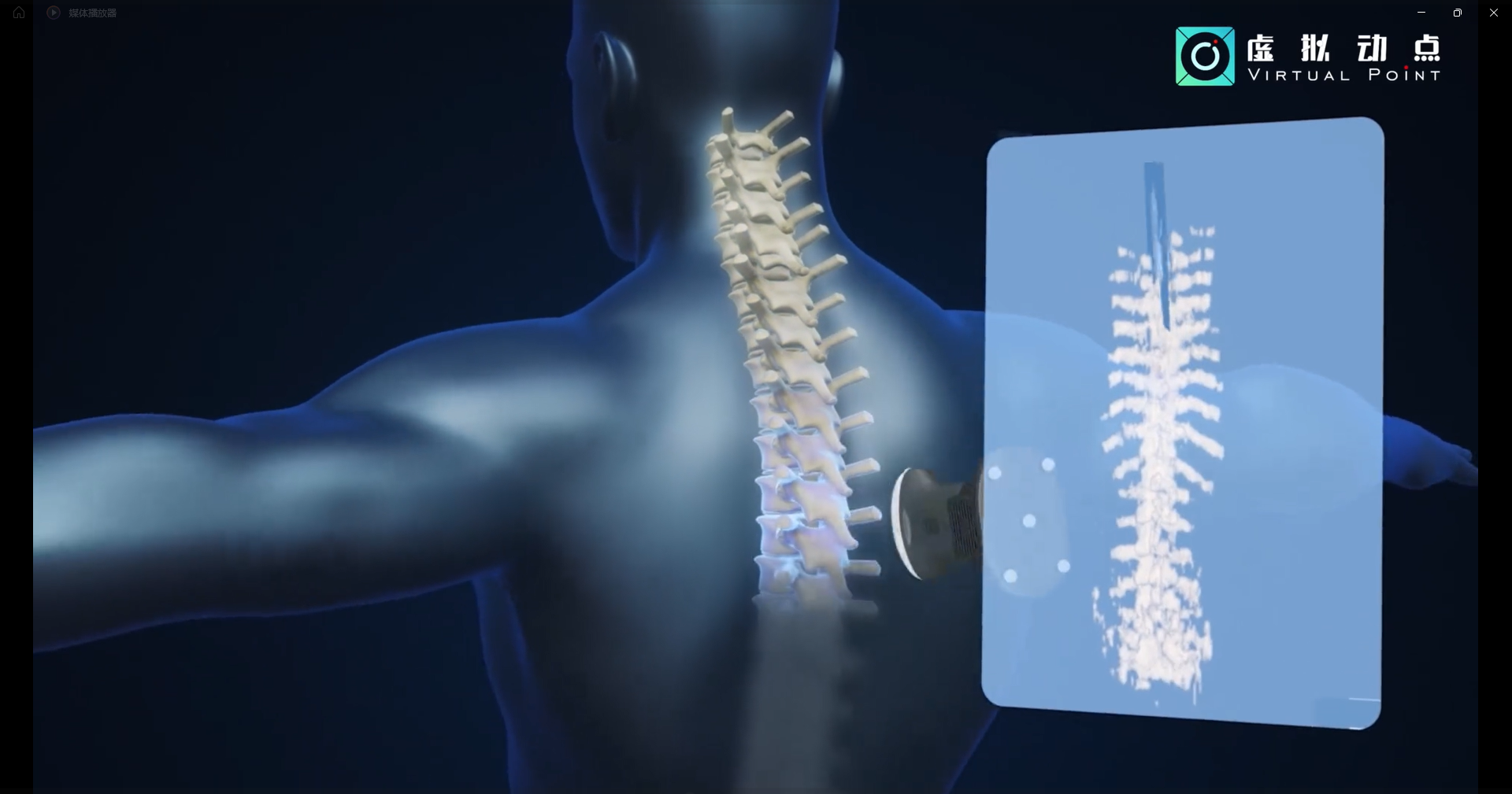 金年金字招牌·虚拟动点OptiTrack开创3D超声成像在脊柱诊断中的应用